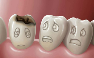 Лечение кариеса киев