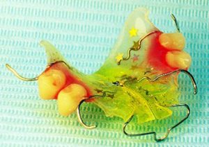 Ортодонтические пластинки цена